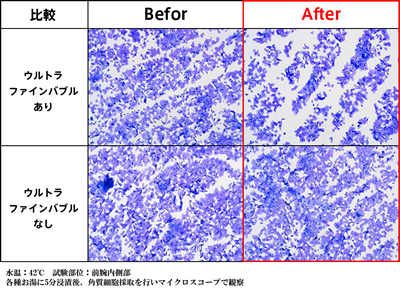  ウルトラファインバブルの微細な泡によって、積み重なった不要な角質が取れ、透明感が増した肌へと導きます。 
